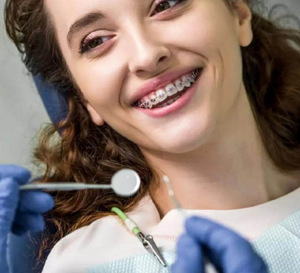 doi tuong nieng rang